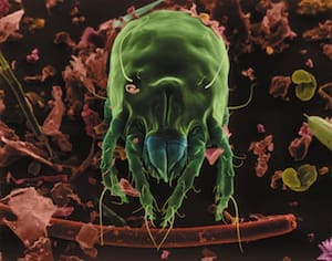Microscopic green mite with detailed body parts on a textured surface.