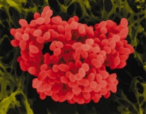 Close-up of red bacterial colonies on a dark surface.